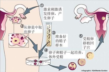 供卵机构电话